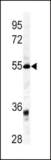 GDF6 / BMP13 Antibody - Western blot of GDF6 antibody in mouse kidney tissue lysates (35 ug/lane). GDF6 (arrow) was detected using the purified antibody.