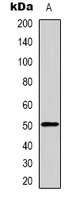 GDF6 / BMP13 Antibody - Western blot analysis of GDF6 expression in rat kidney (A) whole cell lysates.