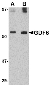 GDF6 / BMP13 Antibody - Western blot of GDF6 in SK-N-SH lysate with GDF6 antibody at (A) 0.5 and (B) 1 ug/ml.