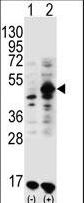 GDF9 / GDF-9 Antibody - Western blot of GDF9 (arrow) using rabbit polyclonal GDF9 Antibody (M45). 293 cell lysates (2 ug/lane) either nontransfected (Lane 1) or transiently transfected (Lane 2) with the GDF9 gene.