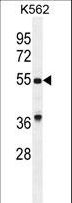 GDF9 / GDF-9 Antibody - GDF9 Antibody western blot of K562 cell line lysates (35 ug/lane). The GDF9 antibody detected the GDF9 protein (arrow).