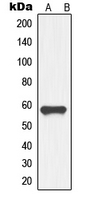 GDF9 / GDF-9 Antibody - Western blot analysis of GDF9 expression in HL60 (A) whole cell lysates.