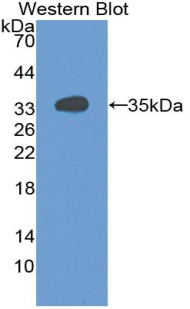 GDI1 Antibody - Western blot of GDI1 antibody.