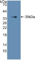 GDI1 Antibody - Western Blot; Sample: Recombinant GDI1, Human.