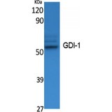 GDI1 Antibody - Western blot of GDI-1 antibody