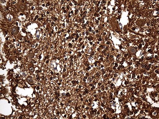 GDI1 Antibody - Immunohistochemical staining of paraffin-embedded Human embryonic cerebellum within the normal limits using anti-GDI1 mouse monoclonal antibody. (Heat-induced epitope retrieval by 1mM EDTA in 10mM Tris buffer. (pH8.5) at 120 oC for 3 min. (1:10000)