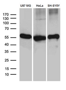 GDI1 Antibody - Western blot analysis of extracts. (35ug) from 3 cell lines by using anti-GDI1 monoclonal antibody. (1:500)