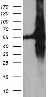 GDI1 Antibody - HEK293T cells were transfected with the pCMV6-ENTRY control. (Left lane) or pCMV6-ENTRY GDI1. (Right lane) cDNA for 48 hrs and lysed