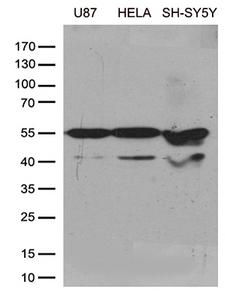 GDI1 Antibody - Western blot analysis of extracts. (35ug) from cell lines and/or tissue lysates by using anti-GDI1 monoclonal antibody. (1:500)