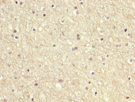 GDI1 Antibody - Immunohistochemistry image at a dilution of 1:200 and staining in paraffin-embedded human brain tissue performed on a Leica BondTM system. After dewaxing and hydration, antigen retrieval was mediated by high pressure in a citrate buffer (pH 6.0) . Section was blocked with 10% normal goat serum 30min at RT. Then primary antibody (1% BSA) was incubated at 4 °C overnight. The primary is detected by a biotinylated secondary antibody and visualized using an HRP conjugated SP system.