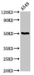 GDI1 Antibody - Positive Western Blot detected in A549 whole cell lysate. All lanes: GDI1 antibody at 6 µg/ml Secondary Goat polyclonal to rabbit IgG at 1/50000 dilution. Predicted band size: 51 KDa. Observed band size: 51 KDa