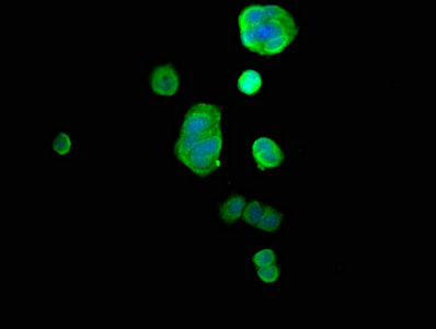 GDI1 Antibody - Immunofluorescence staining of MCF-7 cells with GDI1 Antibody at 1:66, counter-stained with DAPI. The cells were fixed in 4% formaldehyde, permeabilized using 0.2% Triton X-100 and blocked in 10% normal Goat Serum. The cells were then incubated with the antibody overnight at 4°C. The secondary antibody was Alexa Fluor 488-congugated AffiniPure Goat Anti-Rabbit IgG(H+L).