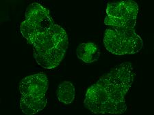 GDI1 Antibody - Immunofluorescence staining of GDI1 in MCF7 cells. Cells were fixed with 4% PFA, permeabilzed with 0.3% Triton X-100 in PBS, blocked with 10% serum, and incubated with rabbit anti-human GDI1 polyclonal antibody (dilution ratio 1:1000) at 4°C overnight. Then cells were stained with the Alexa Fluor 488-conjugated Goat Anti-rabbit IgG secondary antibody (green). Positive staining was localized to cytoplasm.