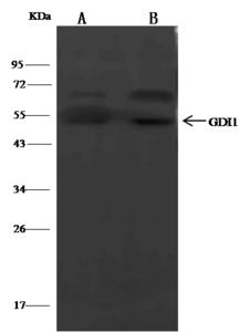 GDI1 Antibody - GDI1 was immunoprecipitated using: Lane A: 0.5 mg Hela Whole Cell Lysate. Lane B: 0.5 mg U87MG Whole Cell Lysate. 2 uL anti-GDI1 rabbit polyclonal antibody and 15 ul of 50% Protein G agarose. Primary antibody: Anti-GDI1 rabbit polyclonal antibody, at 1:100 dilution. Secondary antibody: Clean-Blot IP Detection Reagent (HRP) at 1:500 dilution. Developed using the DAB staining technique. Performed under reducing conditions. Predicted band size: 49 kDa. Observed band size: 49 kDa.
