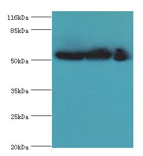 GDI2 Antibody - Western blot. All lanes: GDI2 antibody at 2 ug/ml. Lane 1: mouse brain tissue Lane 2: HepG2 whole cell lysate Lane 3: MCF-7 whole cell lysate. Secondary antibody: goat polyclonal to rabbit at 1:10000 dilution. Predicted band size: 51 kDa. Observed band size: 51 kDa.  This image was taken for the unconjugated form of this product. Other forms have not been tested.