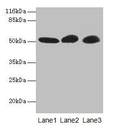 GDI2 Antibody - Western blot All lanes: GDI2 antibody at 2µg/ml Lane 1: Mouse brain tissue Lane 2: HepG2 whole cell lysate Lane 3: MCF-7 whole cell lysate Secondary Goat polyclonal to rabbit IgG at 1/10000 dilution Predicted band size: 51, 46 kDa Observed band size: 51 kDa