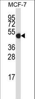 GDI2 Antibody - GDI2 Antibody western blot of MCF-7 cell line lysates (35 ug/lane). The GDI2 antibody detected the GDI2 protein (arrow).