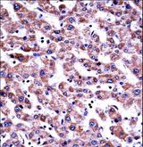 GDI2 Antibody - GDI2 Antibody immunohistochemistry of formalin-fixed and paraffin-embedded human liver tissue followed by peroxidase-conjugated secondary antibody and DAB staining.