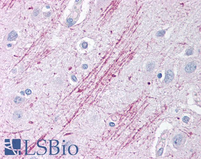 GDI2 Antibody - Anti-GDI2 antibody IHC of human brain, cortex. Immunohistochemistry of formalin-fixed, paraffin-embedded tissue after heat-induced antigen retrieval. Antibody concentration 5 ug/ml.  This image was taken for the unconjugated form of this product. Other forms have not been tested.