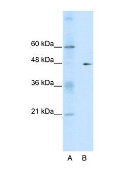 GDI2 Antibody - GDI2 antibody Western blot of HepG2 Cell lysate. Antibody concentration 1 ug/ml. This image was taken for the unconjugated form of this product. Other forms have not been tested.