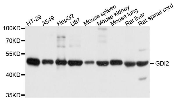 GDI2 Antibody - Western blot analysis of extract of various cells.