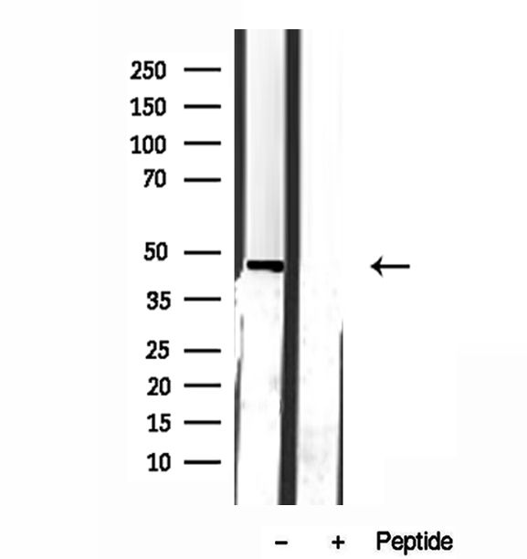 GDI2 Antibody - Western blot analysis of extracts of rat brain tissue using GDI2 antibody.