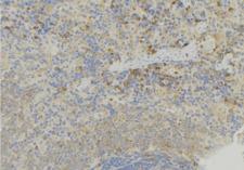 GDI2 Antibody - 1:100 staining human lymph node tissue by IHC-P. The sample was formaldehyde fixed and a heat mediated antigen retrieval step in citrate buffer was performed. The sample was then blocked and incubated with the antibody for 1.5 hours at 22°C. An HRP conjugated goat anti-rabbit antibody was used as the secondary.