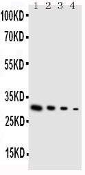 GDNF Antibody - Anti-GDNF antibody, Western blotting Lane 1: Recombinant Human GDNF Protein 10ng Lane 2: Recombinant Human GDNF Protein 5ng Lane 3: Recombinant Human GDNF Protein 2. 5ng Lane 4: Recombinant Human GDNF Protein 1. 25ng