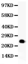 GDNF Antibody - GDNF antibody Western blot. All lanes: Anti-GDNF at 0.5 ug/ml. WB: Rat Brain Tissue Lysate at 40 ug. Predicted band size: 24 kD. Observed band size: 24 kD.