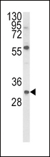 GDNF Antibody - Western blot of GDNF Antibody in mouse NIH-3T3 cell line lysates (35 ug/lane). GDNF (arrow) was detected using the purified antibody.
