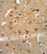 GDNF Antibody - Formalin-fixed and paraffin-embedded human brain tissue reacted with GDNF Antibody , which was peroxidase-conjugated to the secondary antibody, followed by DAB staining. This data demonstrates the use of this antibody for immunohistochemistry; clinical relevance has not been evaluated.