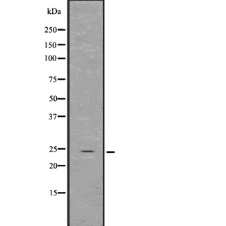 GDNF Antibody - Western blot analysis of GDNF using NIH-3T3 whole lysates.