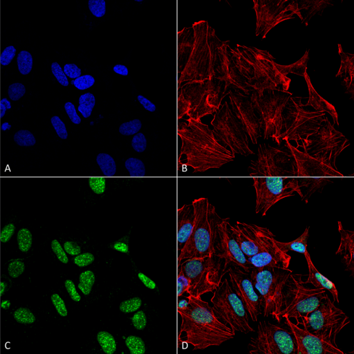 GDNF Antibody - Immunocytochemistry/Immunofluorescence analysis using Rabbit Anti-GDNF Polyclonal Antibody. Tissue: Neuroblastoma cell line (SK-N-BE). Species: Human. Fixation: 4% Formaldehyde for 15 min at RT. Primary Antibody: Rabbit Anti-GDNF Polyclonal Antibody  at 1:100 for 60 min at RT. Secondary Antibody: Goat Anti-Rabbit ATTO 488 at 1:200 for 60 min at RT. Counterstain: Phalloidin Texas Red F-Actin stain; DAPI (blue) nuclear stain at 1:1000, 1:5000 for 60 min at RT, 5 min at RT. Localization: Vesicles, Nucleoplasm. Magnification: 60X. (A) DAPI (blue) nuclear stain (B) Phalloidin Texas Red F-Actin stain (C) GDNF Antibody (D) Composite.