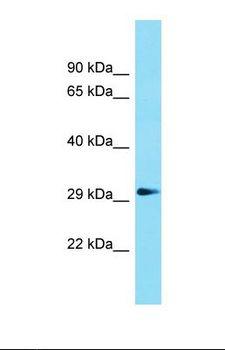 GDPD1 Antibody - Western blot of Rat Muscle. Gdpd1 antibody dilution 1.0 ug/ml.  This image was taken for the unconjugated form of this product. Other forms have not been tested.