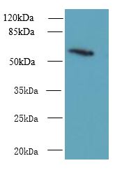 GDPD2 / GDE3 Antibody - Western blot. All lanes: GDPD2 antibody at 1.5 ug/ml+ A431 whole cell lysate Goat polyclonal to rabbit at 1:10000 dilution. Predicted band size: 62 kDa. Observed band size: 62 kDa.