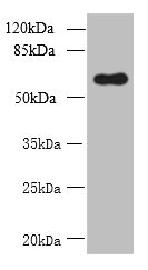 GDPD2 / GDE3 Antibody - Western blot All lanes: GDPD2 antibody at 1.5µg/ml + A431 whole cell lysate Secondary Goat polyclonal to rabbit IgG at 1/10000 dilution Predicted band size: 62, 53, 67 kDa Observed band size: 62 kDa