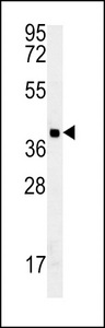 GDPD3 Antibody - GDPD3 Antibody western blot of MDA-MB435 cell line lysates (35 ug/lane). The GDPD3 antibody detected the GDPD3 protein (arrow).