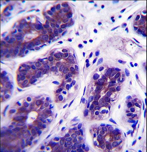GDPD3 Antibody - GDPD3 Antibody immunohistochemistry of formalin-fixed and paraffin-embedded human breast tissue followed by peroxidase-conjugated secondary antibody and DAB staining.