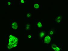 GDPD3 Antibody - Immunofluorescence staining of GDPD3 in MCF7 cells. Cells were fixed with 4% PFA, permeabilzed with 0.1% Triton X-100 in PBS, blocked with 10% serum, and incubated with rabbit anti-Human GDPD3 polyclonal antibody (dilution ratio 1:100) at 4°C overnight. Then cells were stained with the Alexa Fluor 488-conjugated Goat Anti-rabbit IgG secondary antibody (green). Positive staining was localized to Nucleus.