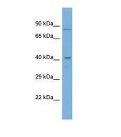 GDPD5 Antibody - Western blot of Human COLO205. GDPD5 antibody dilution 1.0 ug/ml.  This image was taken for the unconjugated form of this product. Other forms have not been tested.