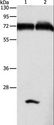GDPD5 Antibody - Western blot analysis of Mouse pancreas and human fetal brain tissue, using GDPD5 Polyclonal Antibody at dilution of 1:600.