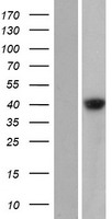 GDPGP1 / C15orf58 Protein - Western validation with an anti-DDK antibody * L: Control HEK293 lysate R: Over-expression lysate