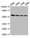 gelE Antibody - Positive WB detected in Recombinant protein;All lanes:gelE antibody at 2?g/ml;Secondary;Goat polyclonal to rabbit IgG at 1/50000 dilution;predicted band size: 56 KDa;observed band size: 56 KDa;