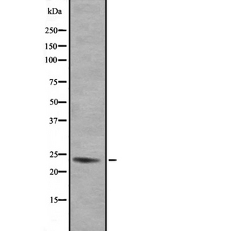 GEM / KIR Antibody - Western blot analysis of GEM expression in 293 lysate. The lane on the left is treated with the antigen-specific peptide.
