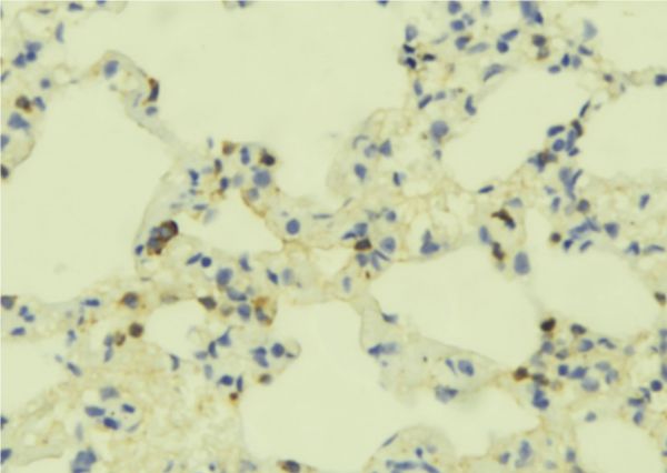 GEM / KIR Antibody - 1:100 staining mouse lung tissue by IHC-P. The sample was formaldehyde fixed and a heat mediated antigen retrieval step in citrate buffer was performed. The sample was then blocked and incubated with the antibody for 1.5 hours at 22°C. An HRP conjugated goat anti-rabbit antibody was used as the secondary.