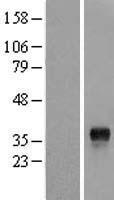 GEM / KIR Protein - Western validation with an anti-DDK antibody * L: Control HEK293 lysate R: Over-expression lysate