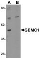 GEMC1 / GMNC Antibody - Western blot analysis of GEMC1 in mouse heart tissue lysate with GEMC1 antibody at 1 ug/ml in (A) the absence and (B) the presence of blocking peptide