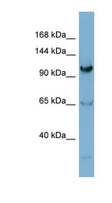 GEMIN4 Antibody - GEMIN4 antibody Western blot of Jurkat lysate. This image was taken for the unconjugated form of this product. Other forms have not been tested.