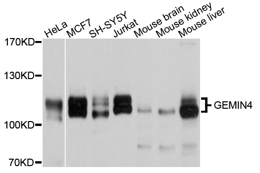 GEMIN4 Antibody - Western blot analysis of extracts of various cell lines, using GEMIN4 antibody at 1:1000 dilution. The secondary antibody used was an HRP Goat Anti-Rabbit IgG (H+L) at 1:10000 dilution. Lysates were loaded 25ug per lane and 3% nonfat dry milk in TBST was used for blocking. An ECL Kit was used for detection and the exposure time was 10s.