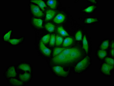 GEMIN4 Antibody - Immunofluorescence staining of A549 cells at a dilution of 1:133, counter-stained with DAPI. The cells were fixed in 4% formaldehyde, permeabilized using 0.2% Triton X-100 and blocked in 10% normal Goat Serum. The cells were then incubated with the antibody overnight at 4 °C.The secondary antibody was Alexa Fluor 488-congugated AffiniPure Goat Anti-Rabbit IgG (H+L) .